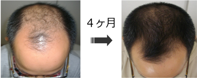 яǗ2