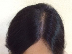 After(6ヶ月後)