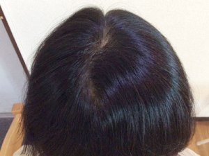 After(6ヶ月後)