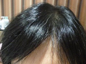 After(6ヶ月後)