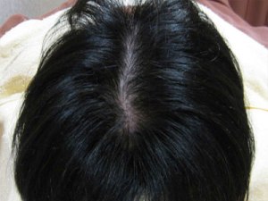 After(6ヶ月後)