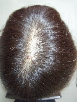 Before